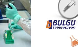 Spermiyogram Testi Nasıl Yapılır?