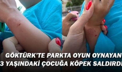 Göktürk'te Parkta oyun oynayan 3 yaşındaki çocuğa köpek saldırdı