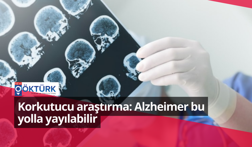 Korkutucu araştırma: Alzheimer bu yolla yayılabilir