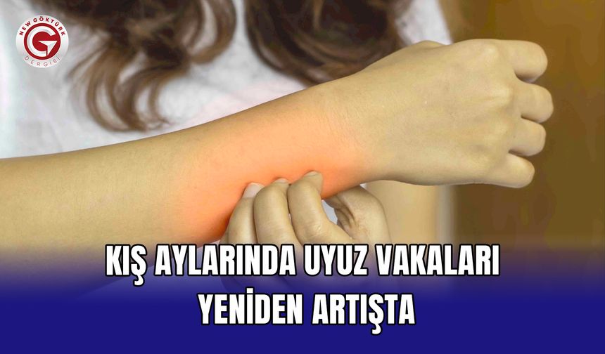 Kış aylarında uyuz vakaları yeniden artışta